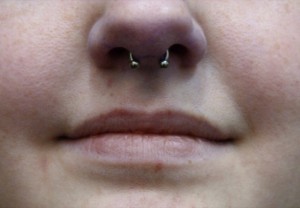 L Septum (11)