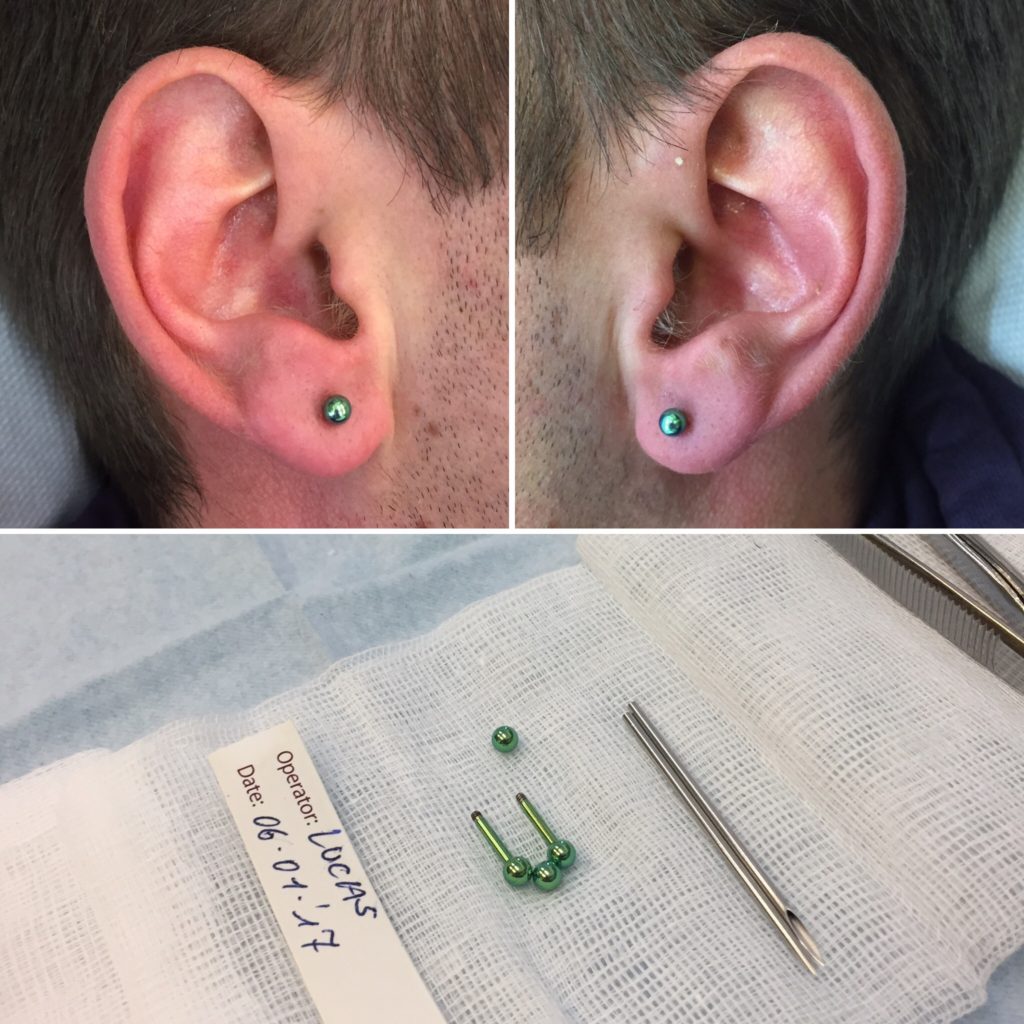 Bring some colour to your piercings with our anodizing option